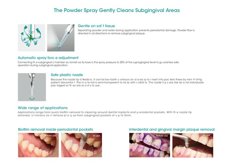 The Benefits of Airflow Treatment at Ham Dental Practice Ham Dental